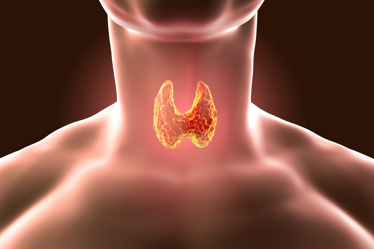 8 Disorders That Cause Thyroid Disease