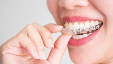 The Reasons To Redesign Your Smile With Invisalign?