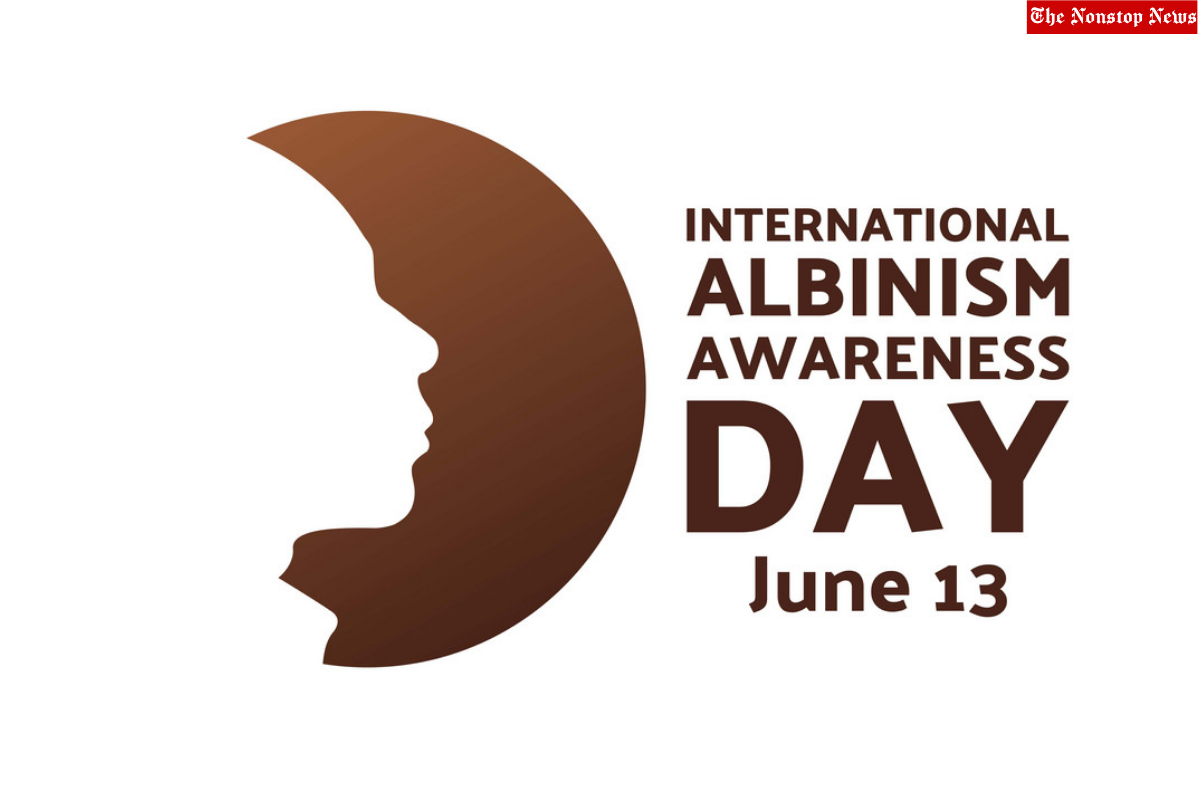 International Albinism Awareness Day 2022: Current Theme, Quotes, Images, Slogans, Posters to Share