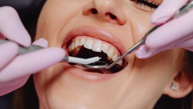 Dental Problems and Their Treatments