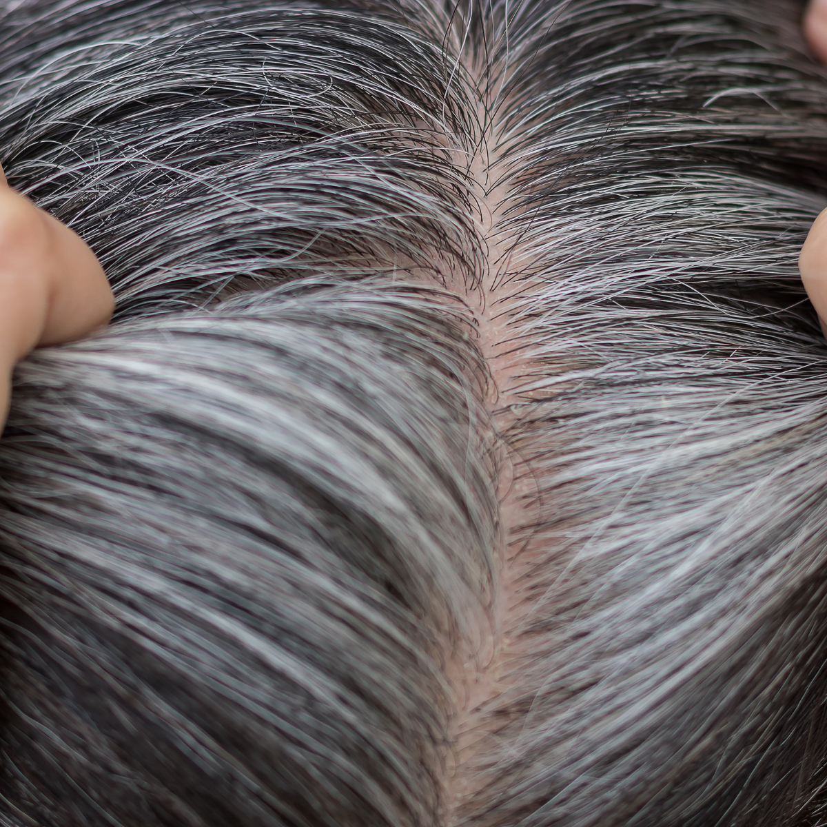 9 Solutions to stop grey hair naturally