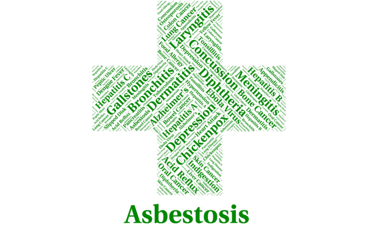 Understanding Asbestosis: Frequently Asked Questions