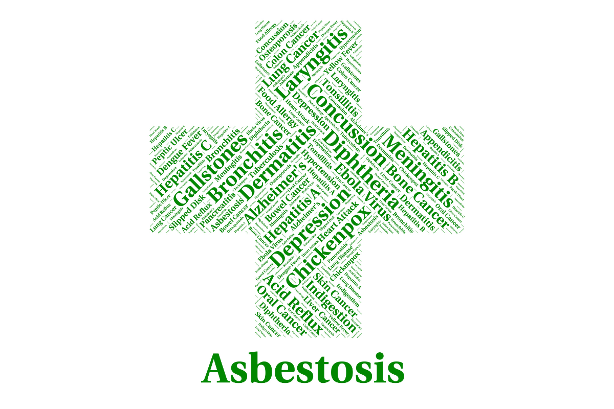 Understanding Asbestosis: Frequently Asked Questions
