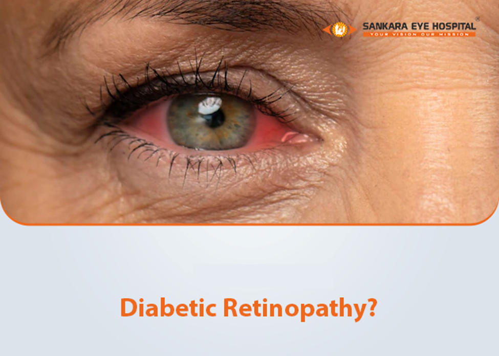 Can Diabetic Retinopathy Be Reversed? Exploring Treatment Options